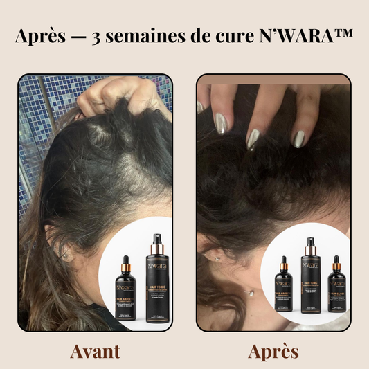 02 Hair Growth concentrated – Bain d’huile repousse intensif 100 % naturel