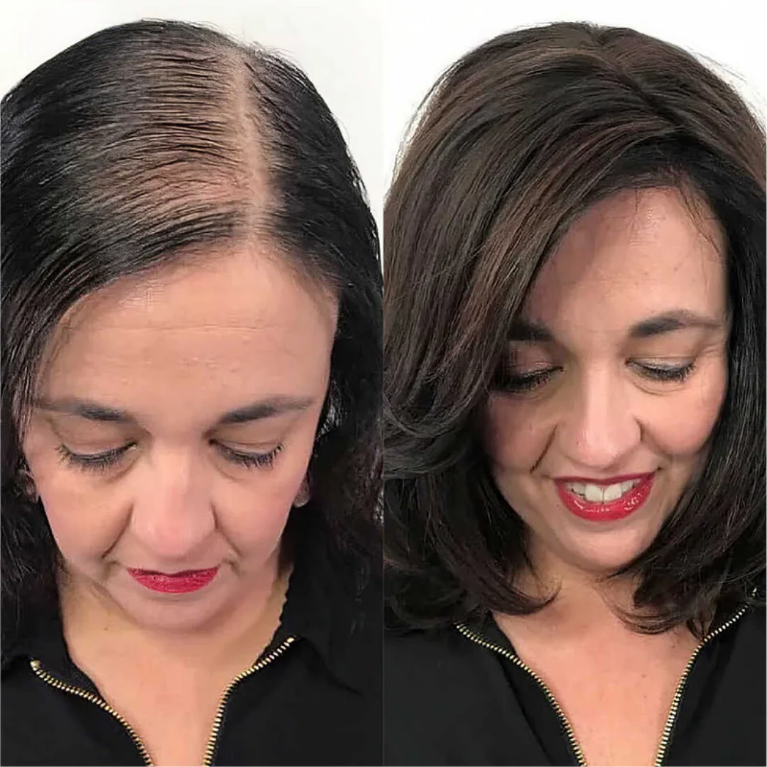 N'wara™ | Cure Capillaire Repousse Extrême