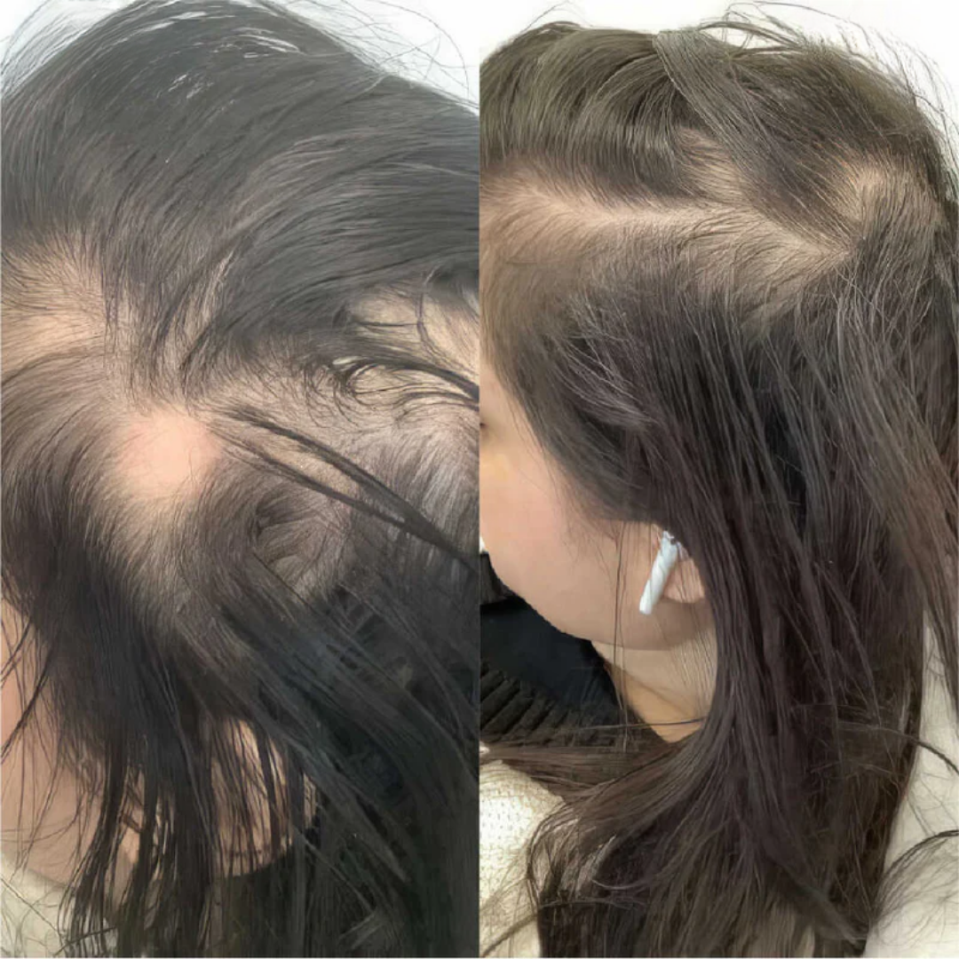 N'wara™ | Cure Capillaire Repousse Extrême