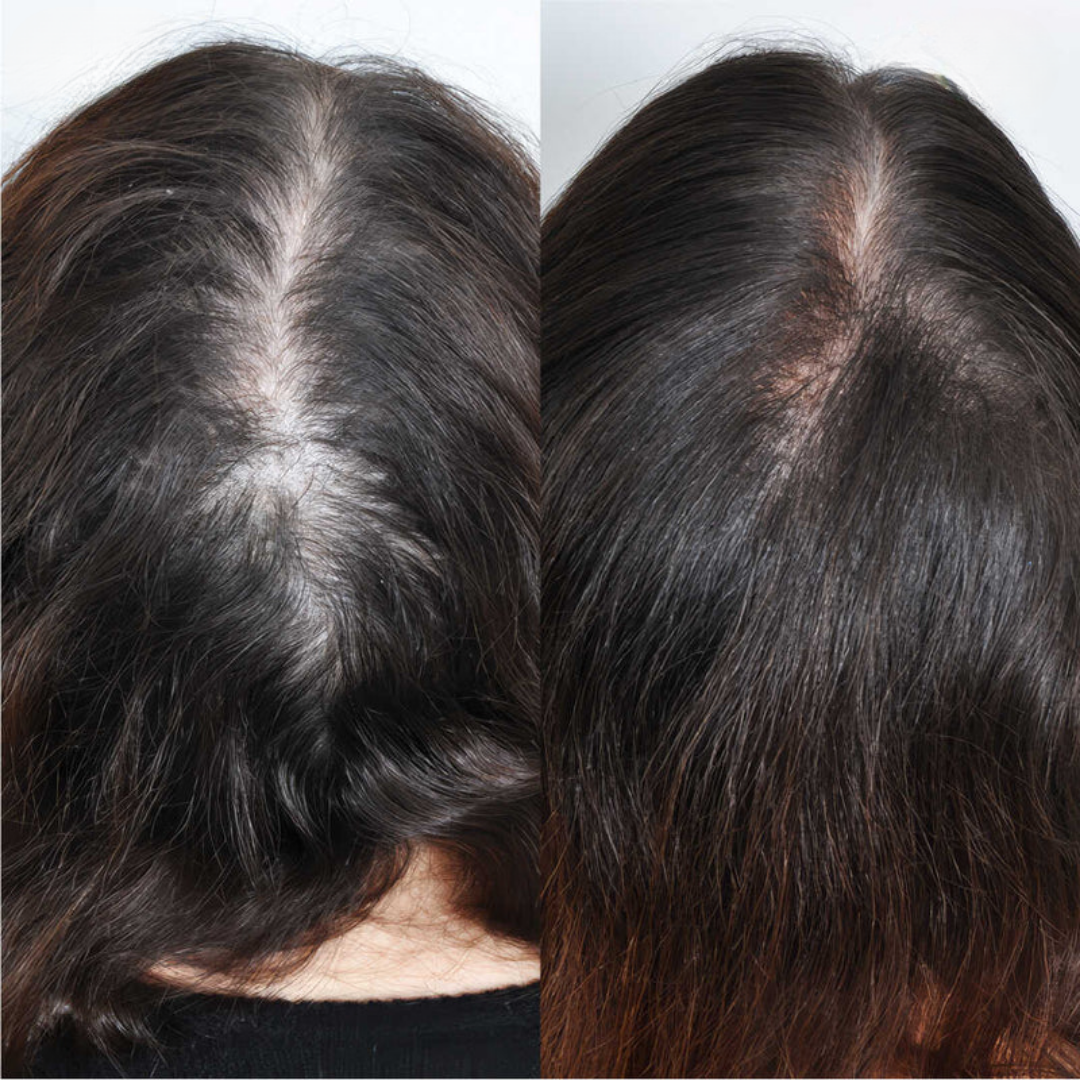 N'wara™ | Cure Capillaire Repousse Extrême