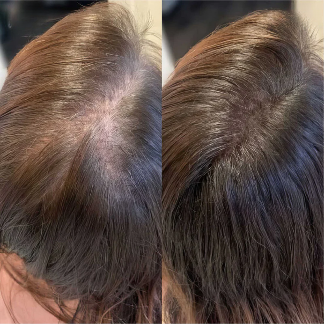 N'wara™ | Cure Capillaire Repousse Extrême