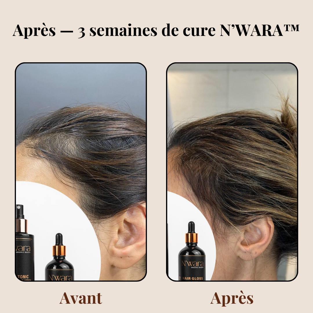 01 Hair Tonic – Spray Soin naturel anti-chute & repousse intense